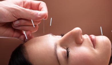 Acupuntura: o que é, benefícios e como diminui ansiedade